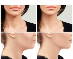 Glowâ„?| Improve your skin!