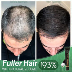 NextGrowâ„?Prevents bald spots | TODAY ONLY 1 + 1 FREE
