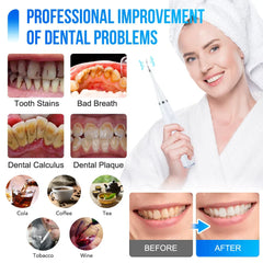 ToothCleanerâ„?- Effective care for your teeth!