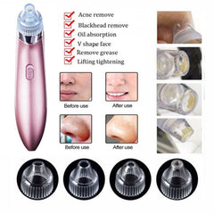 Facial Pore Blackhead Cleaner Remover