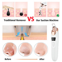 Glamvac Cleanerâ„?- Skin care and rejuvenation