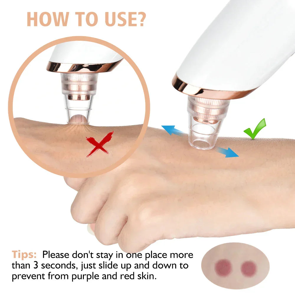 Glamvac Cleanerâ„?- Skin care and rejuvenation