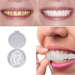 HappySmileâ„?Brace Simulation Dentures | 50% off