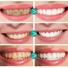WhiteSmileâ„?- The solution against yellow teeth! | Temporary 1 + 1 Free