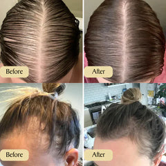 Carvenchyâ„?Prevention of Hair Loss | Temporarily 1+1 Free